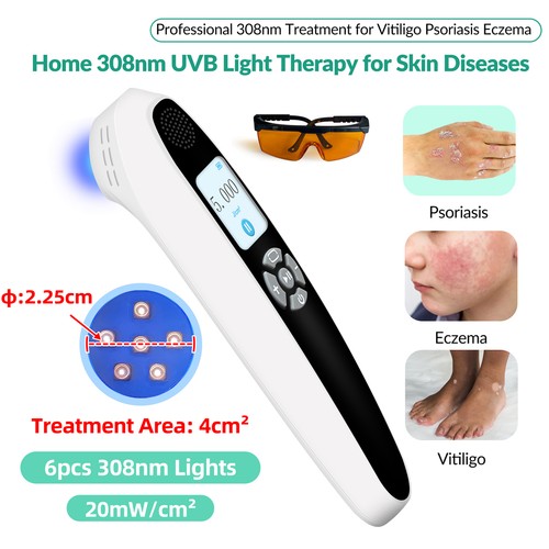308nm uvb phototherapie gerät - uvb,